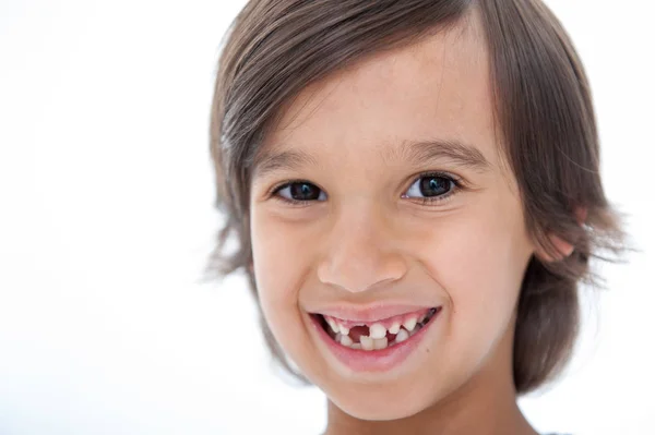 Young Boy Lost His Tooth — Stock Photo, Image