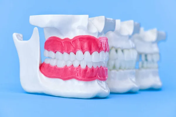 Mänskliga käkar med tänder och tandkött anatomi modeller — Stockfoto