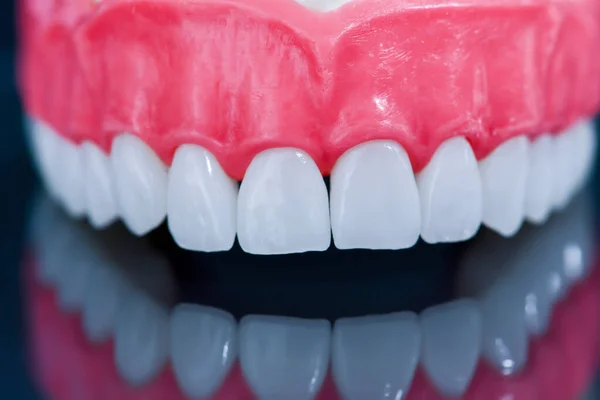 Upper human jaw model with a reflection on the glass — Stock Photo, Image