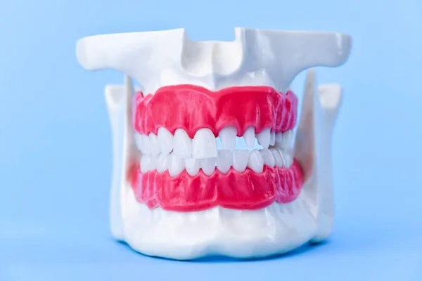 Human jaw with teeth and gums anatomy model — Stock Photo, Image