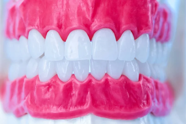 有牙齿和牙龈的人类下颌骨解剖模型 — 图库照片