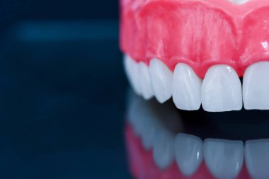 Camda yansıması olan üst çene modeli