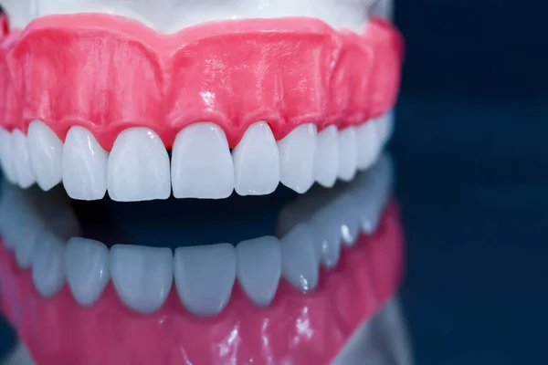 Bovenmenselijk kaakmodel met een reflectie op het glas — Stockfoto