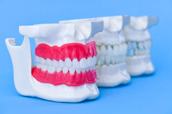 Mandíbulas humanas com modelos anatômicos de dentes e gengivas — Fotografia de Stock