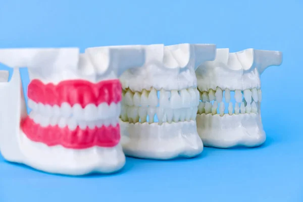 Human jaws with teeth and gums anatomy models — Stock Photo, Image