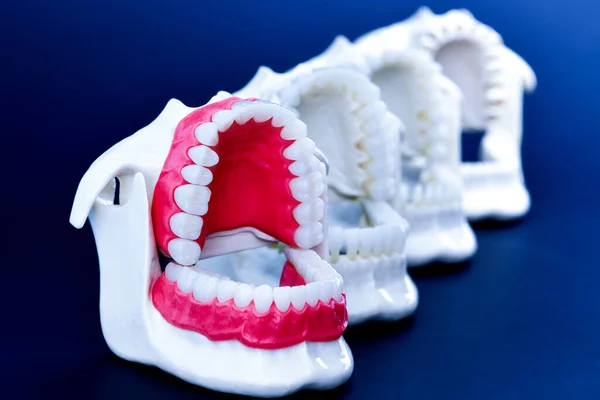 Fogászati fogászati fogászati modellek — Stock Fotó