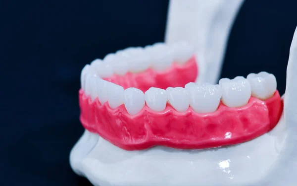 Dolna szczęka ludzka z zębami i dziąsłami model anatomiczny — Zdjęcie stockowe
