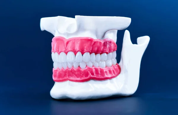 Модель анатомії щелепи людини з зубами та яснами — стокове фото