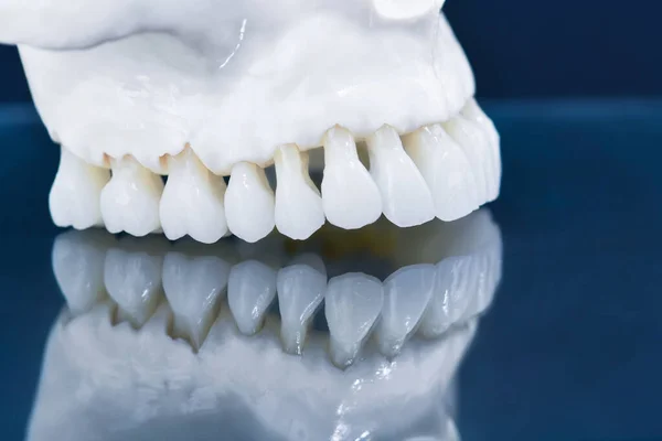 Modelo de mandíbula humana superior con un reflejo en el vidrio —  Fotos de Stock