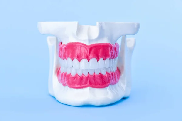 이빨 이 있는 사람 턱 과 잇몸 해부학 모델 — 스톡 사진