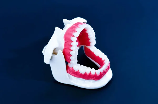 Model zębów ortodontycznych u dentysty — Zdjęcie stockowe