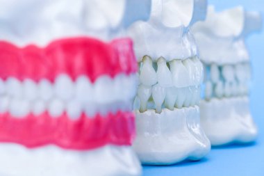 Dişleri ve diş etleri olan insan çeneleri anatomi modelleri