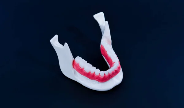 Lower human jaw with teeth and gums anatomy model — Stock Photo, Image