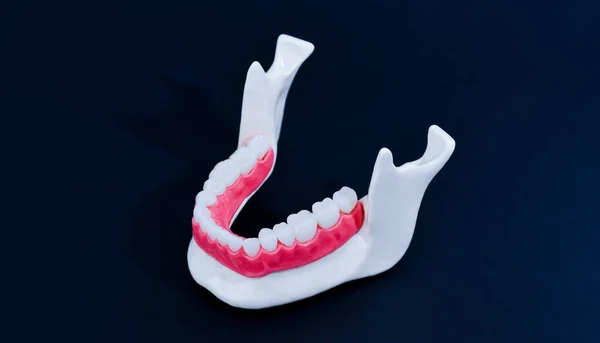 Mandíbula humana inferior con modelo de anatomía de dientes y encías —  Fotos de Stock