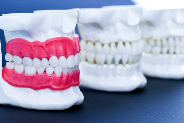 Mandíbulas humanas con modelos de anatomía de dientes y encías —  Fotos de Stock