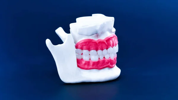 Human jaw with teeth and gums anatomy model — Stock Photo, Image