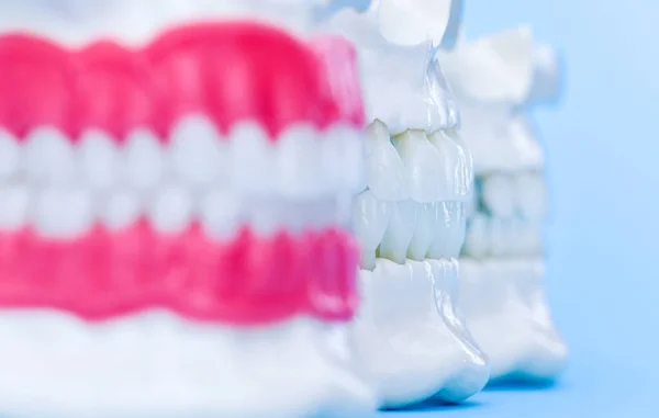 Ludzkie szczęki z zębami i gumy modele anatomiczne — Zdjęcie stockowe