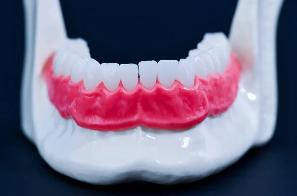 이빨 과 잇몸 해부학 모델 이 있는 아래턱 — 스톡 사진
