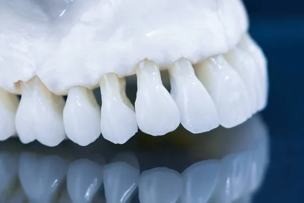 Modelo de mandíbula humana superior con un reflejo en el vidrio — Foto de Stock