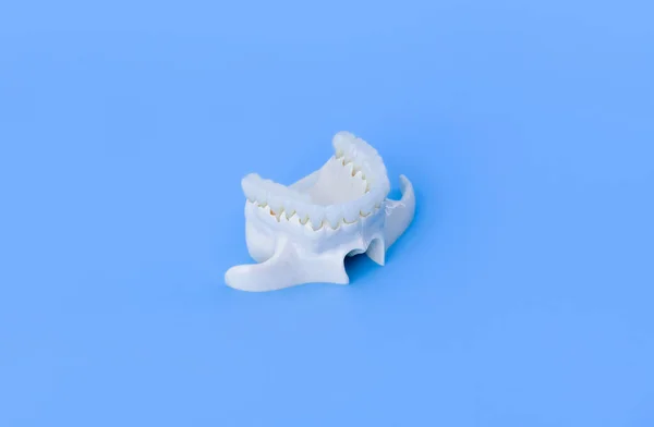 Maxila humana superior com dentes — Fotografia de Stock