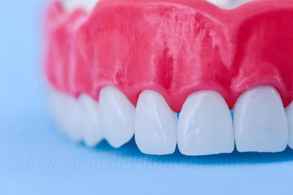 Horní lidská čelist se zuby a dásní anatomický model — Stock fotografie