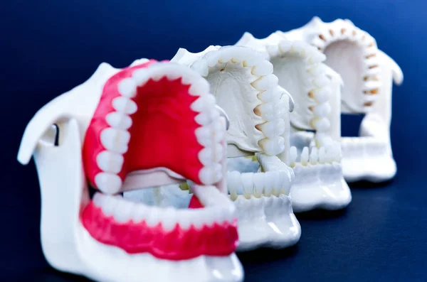 Dentist orthodontic teeth models — Stock Photo, Image