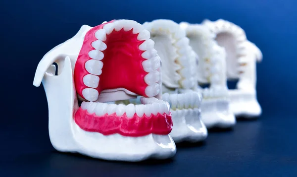 Dentist orthodontic teeth models — Stock Photo, Image