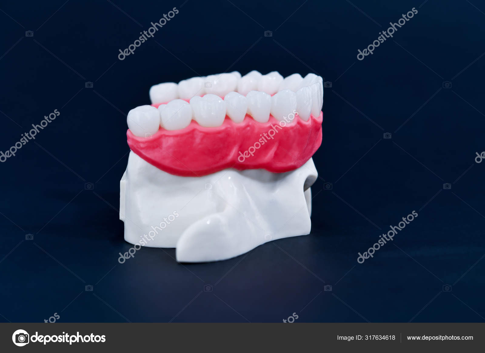 上颌骨 牙齿和牙龈解剖模型 图库照片 C Shock