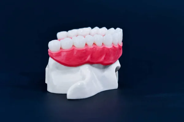 Mandíbula humana superior con modelo de anatomía de dientes y encías —  Fotos de Stock
