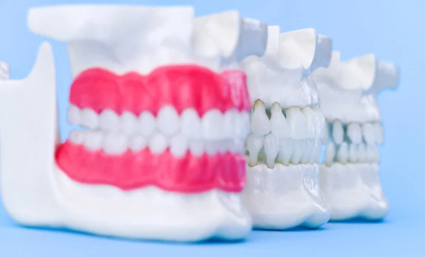 Emberi állkapocs fogak és íny anatómia modellek — Stock Fotó