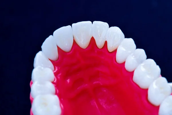 Mandíbula humana superior con modelo de anatomía de dientes y encías —  Fotos de Stock