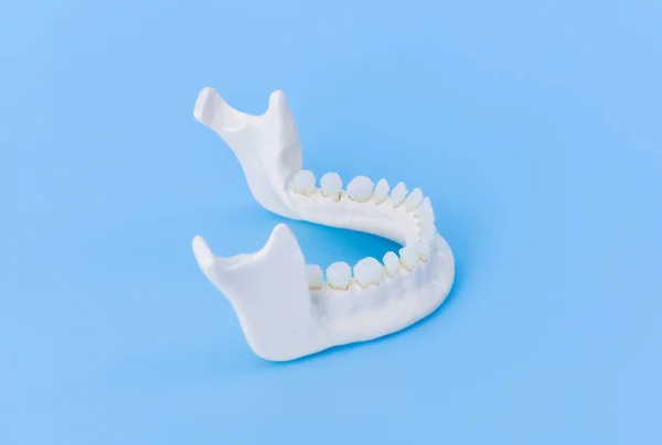치아 해부학 모델 이 있는 아래턱 — 스톡 사진
