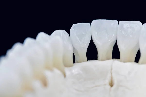 Mandíbula humana inferior com dentes isolados em fundo preto — Fotografia de Stock
