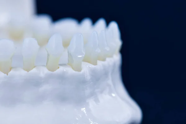 Mandíbula humana inferior com modelo de anatomia dos dentes — Fotografia de Stock