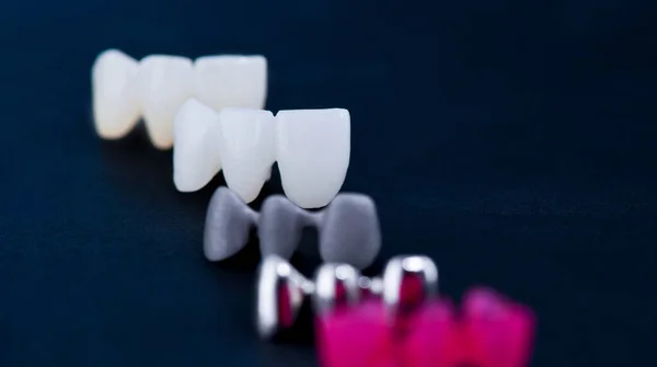 Different types of dental tooth crowns — Stock Photo, Image
