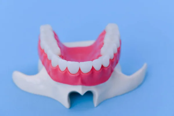 Верхня щелепа людини з анатомічною моделлю зубів і ясен — стокове фото