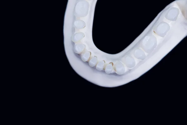Mâchoire humaine inférieure avec dents isolées sur fond noir — Photo