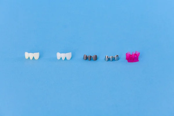 Diferentes tipos de coroas dentárias — Fotografia de Stock