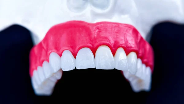 歯と歯茎の解剖学的モデルを持つ上の人間の顎 — ストック写真