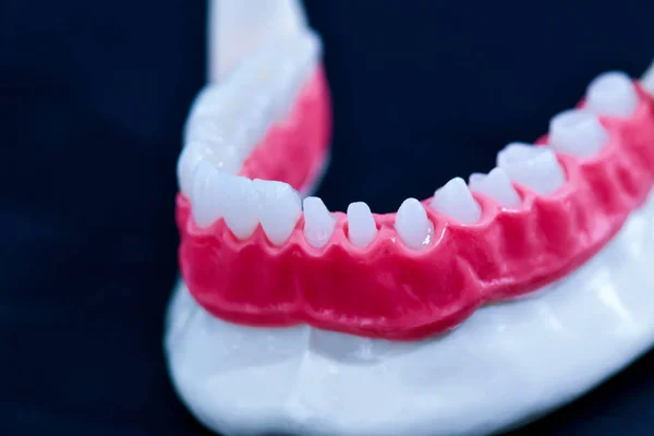 Процес встановлення зубів та коронки — стокове фото