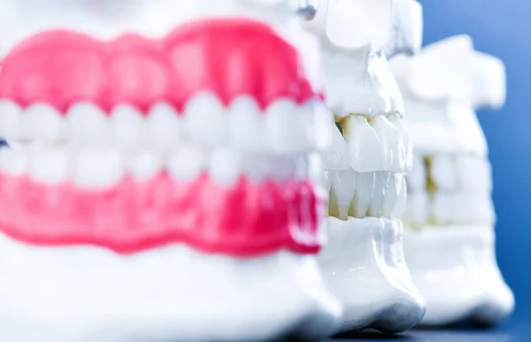 Anatomische Modelle menschlicher Kiefer mit Zähnen und Zahnfleisch — Stockfoto