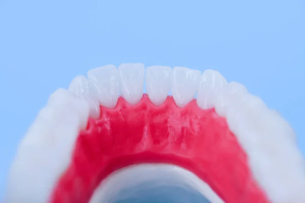 Lägre mänsklig käke med tänder och tandkött anatomi modell — Stockfoto