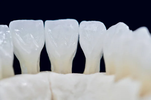 Unterkiefer des Menschen mit isolierten Zähnen auf schwarzem Hintergrund — Stockfoto