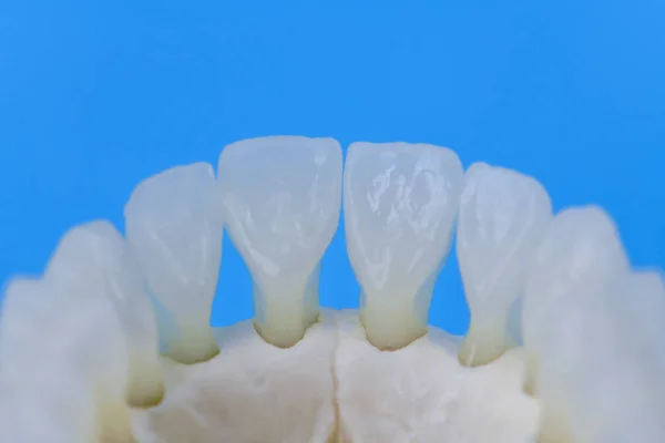 Mandíbula humana inferior com modelo de anatomia dos dentes — Fotografia de Stock