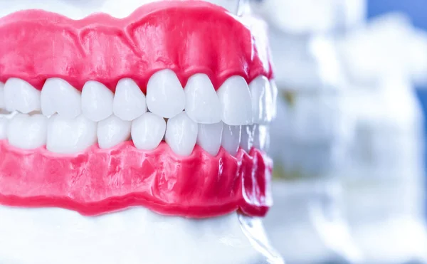 Emberi állkapocs fogak és íny anatómia modellek — Stock Fotó