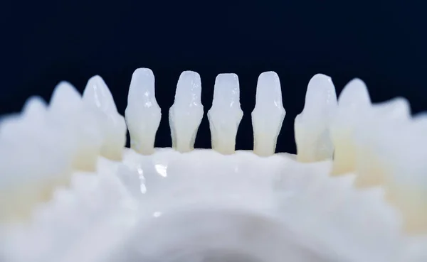 Mandíbula humana inferior com modelo de anatomia dos dentes — Fotografia de Stock