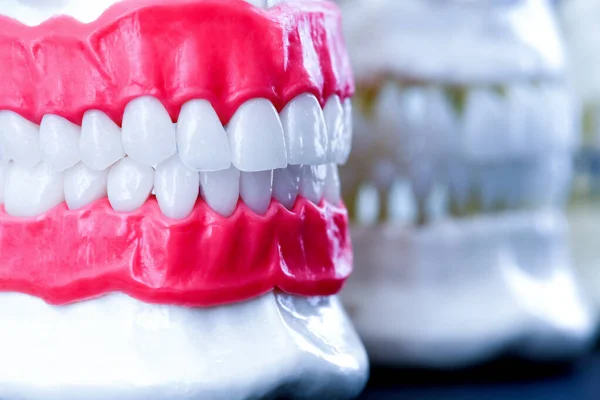 Mandíbulas humanas con modelos de anatomía de dientes y encías — Foto de Stock