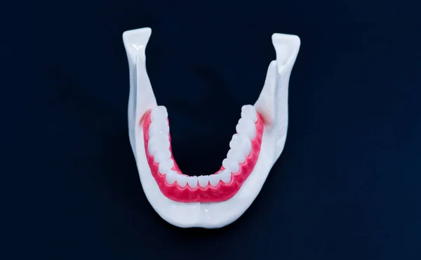 Lower human jaw with teeth and gums anatomy model — Stock Photo, Image