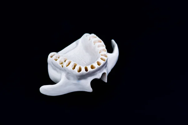 Upper human jaw with teeth isolated on black background — Stock Photo, Image