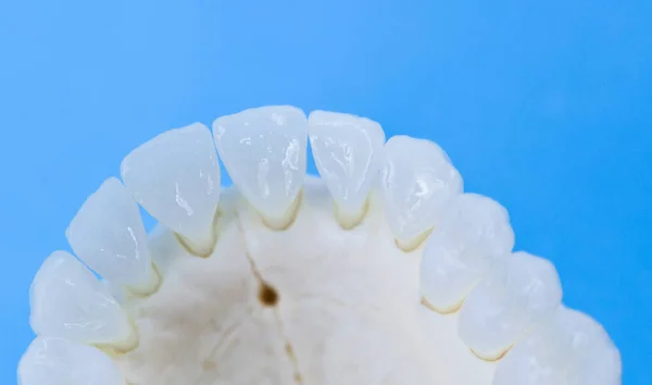 Górna szczęka ludzka z zębami — Zdjęcie stockowe
